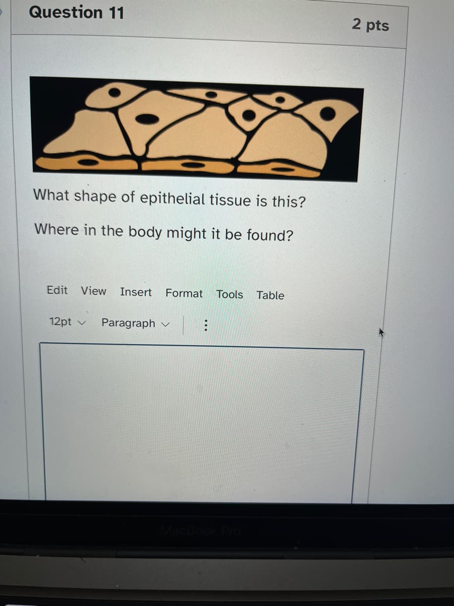 Question 11
What shape of epithelial tissue is this?
Where in the body might be found?
Edit View Insert Format Tools Table
12pt
Paragraph
2 pts