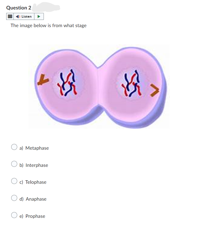 Question 2
Listen
The image below is from what stage
○
a) Metaphase
b) Interphase
c) Telophase
d) Anaphase
e) Prophase