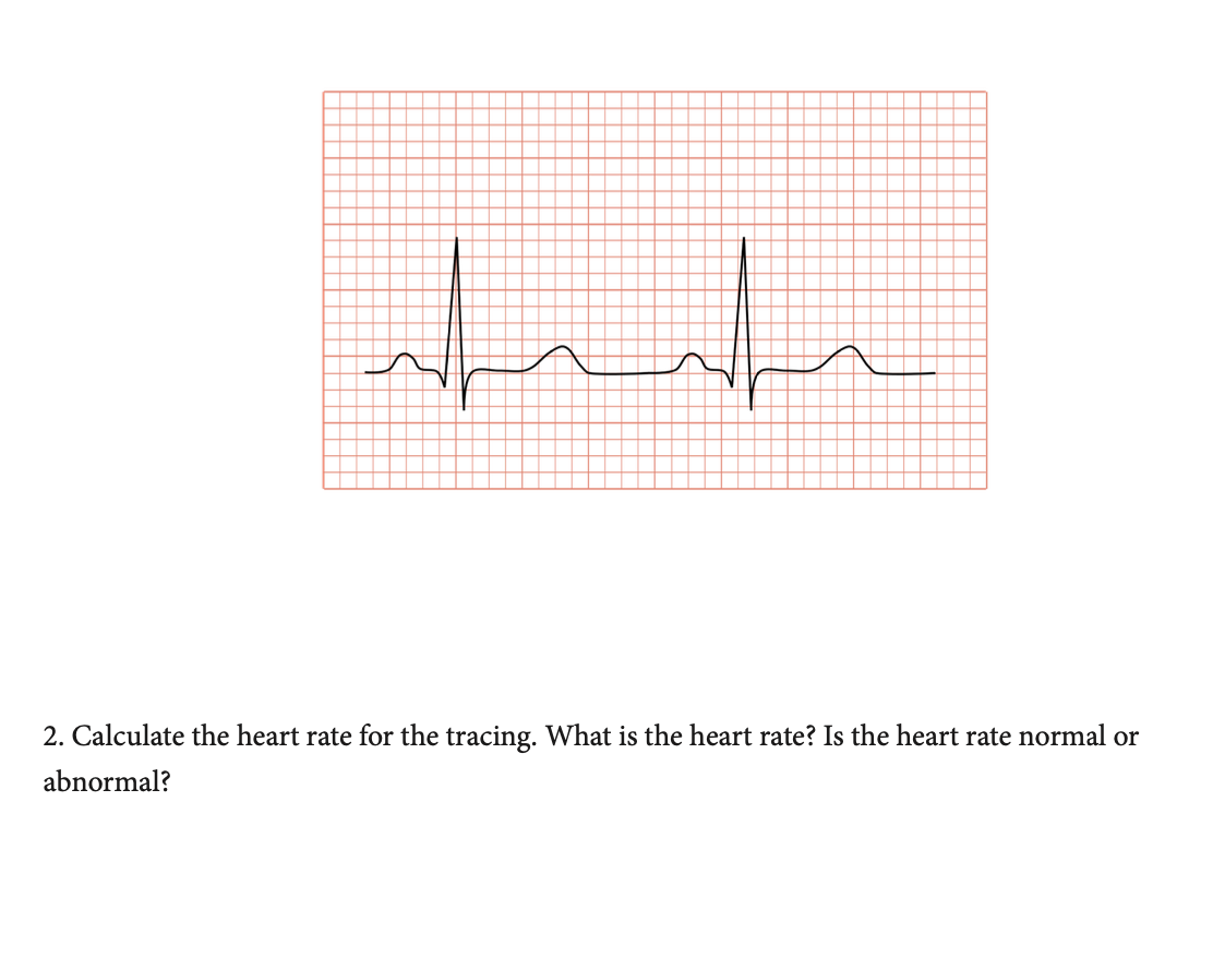2. Calculate the heart rate for the tracing. What is the heart rate? Is the heart rate normal or
abnormal?
