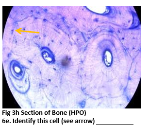 Fig 3h Section of Bone (HPO)
6e. Identify this cell (see arrow)
