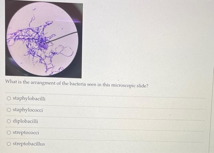 What is the arrangment of the bacteria seen in this microscopic slide?
O staphylobacilli
O staphylococci
O diplobacilli
streptococci
O streptobacillus
