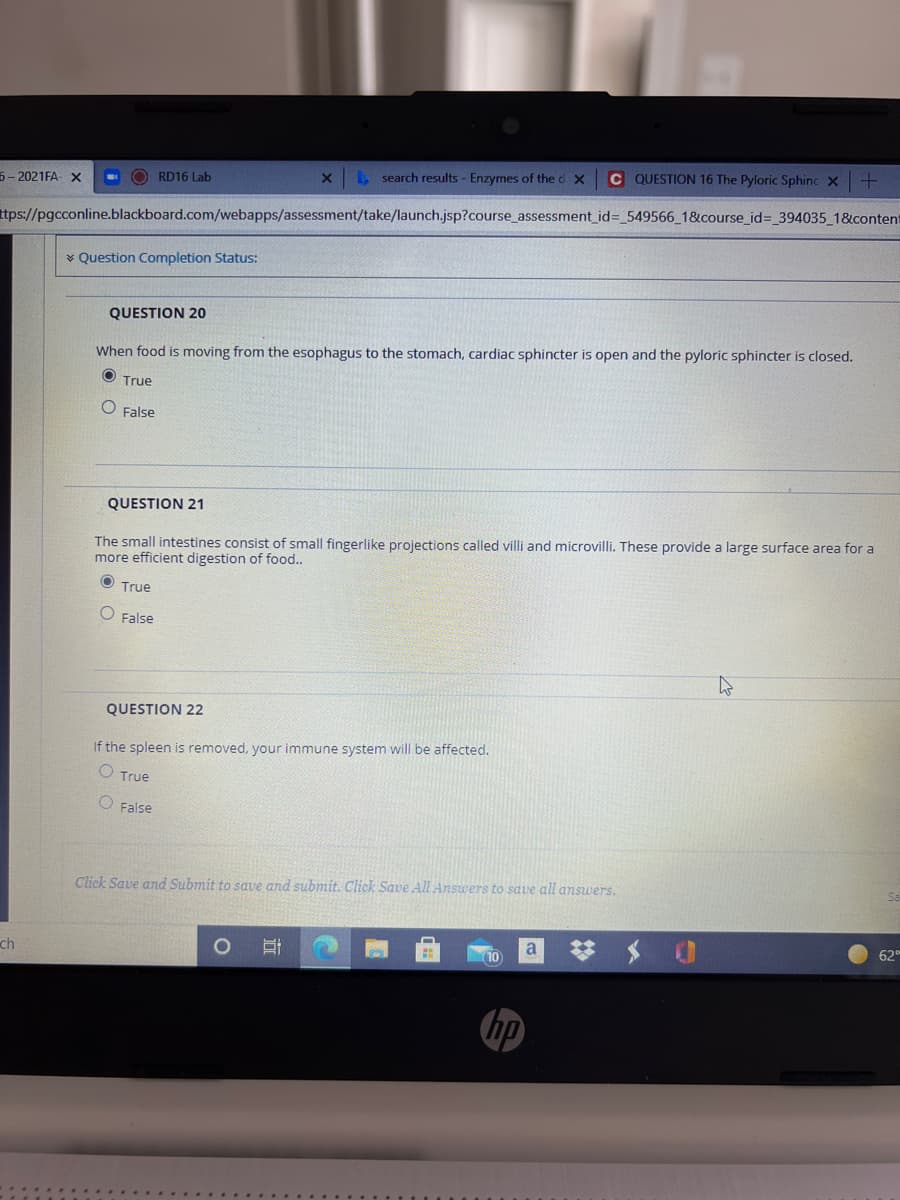 5- 2021FA- x
O RD16 Lab
, search results - Enzymes of the d X
C QUESTION 16 The Pyloric Sphinc X
ttps://pgcconline.blackboard.com/webapps/assessment/take/launch.jsp?course_assessment_id=_549566 1&course_id%3 394035_1&content
* Question Completion Status:
QUESTION 20
When food is moving from the esophagus to the stomach, cardiac sphincter is open and the pyloric sphincter is closed.
True
O False
QUESTION 21
The small intestines consist of small fingerlike projections called villi and microvilli. These provide a large surface area for a
more efficient digestion of food..
O True
O False
QUESTION 22
If the spleen is removed, your immune system will be affected.
O True
O False
Click Save and Submit to save and submit. Click Save All Ansuwers to save all answers.
ch
a
62
hp
