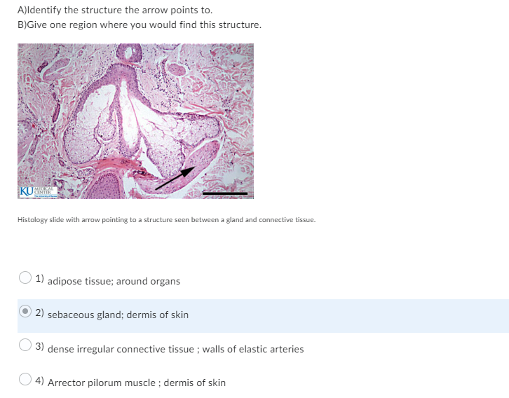 A)Identify the structure the arrow points to.
B)Give one region where you would find this structure.
KUN
Histology slide with arrow pointing to a structure seen between a gland and connective tissue.
1) adipose tissue; around organs
2) sebaceous gland; dermis of skin
3) dense irregular connective tissue ; walls of elastic arteries
4) Arrector pilorum muscle ; dermis of skin