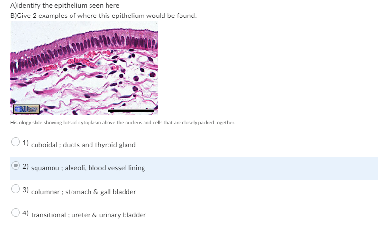 A)Identify the epithelium seen here
B)Give 2 examples of where this epithelium would be found.
ww
Histology slide showing lots of cytoplasm above the nucleus and cells that are closely packed together.
1) cuboidal ; ducts and thyroid gland
2) squamou; alveoli, blood vessel lining
3) columnar; stomach & gall bladder
4) transitional; ureter & urinary bladder