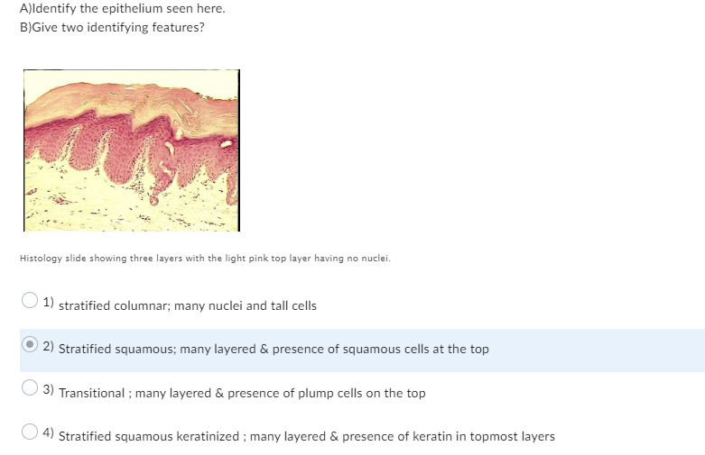 A)Identify the epithelium seen here.
B)Give two identifying features?
Histology slide showing three layers with the light pink top layer having no nuclei.
1) stratified columnar; many nuclei and tall cells
2) Stratified squamous; many layered & presence of squamous cells at the top
3) Transitional; many layered & presence of plump cells on the top
4) Stratified squamous keratinized; many layered & presence of keratin in topmost layers
