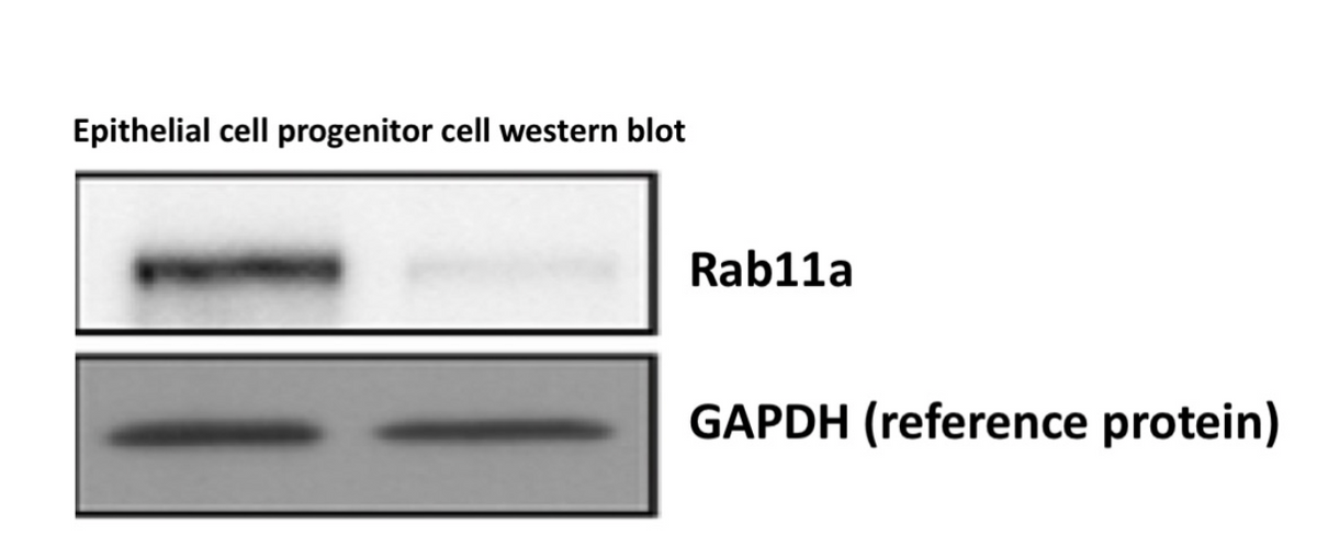 Epithelial cell progenitor cell western blot
Rab11a
GAPDH (reference protein)