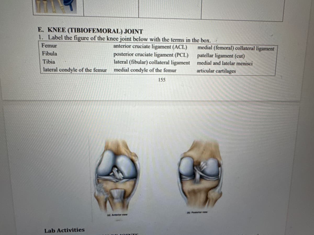 E. KNEE (TIBIOFEMORAL) JOINT
1. Label the figure of the knee joint below with the terms in the box.
Femur
Fibula
Tibia
lateral condyle of the femur
anterior cruciate ligament (ACL)
posterior cruciate ligament (PCL)
lateral (fibular) collateral ligament
medial condyle of the femur
155
medial (femoral) collateral ligament
patellar ligament (cut)
medial and latelar menisci
articular cartilages
Lab Activities
Posterior view