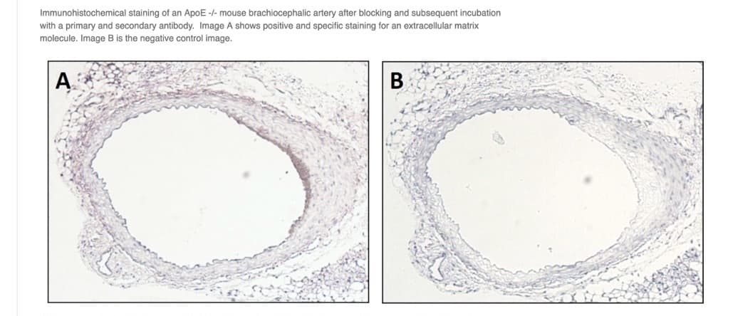 Immunohistochemical staining of an ApoE -/- mouse brachiocephalic artery after blocking and subsequent incubation
with a primary and secondary antibody. Image A shows positive and specific staining for an extracellular matrix
molecule. Image B is the negative control image.
A
B
