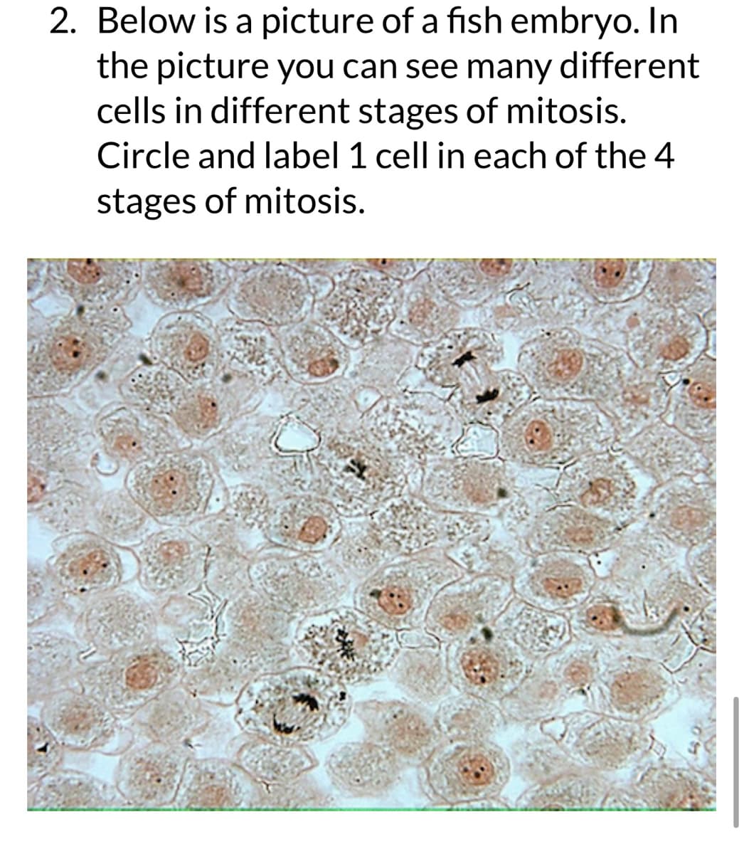 2. Below is a picture of a fish embryo. In
the picture you can see many different
cells in different stages of mitosis.
Circle and label 1 cell in each of the 4
stages of mitosis.