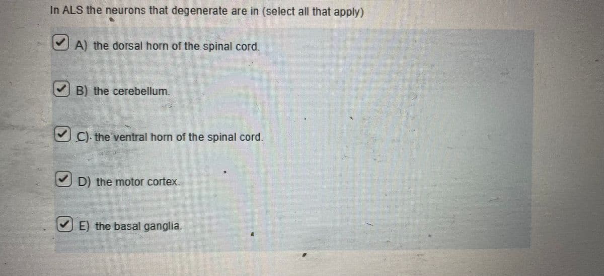 In ALS the neurons that degenerate are in (select all that apply)
A) the dorsal horn of the spinal cord.
B) the cerebellum.
C). the ventral horn of the spinal cord.
D)
D) the m
the
motor cortex.
E) the basal ganglia.