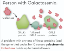 Person with Galactosemia:
Galactose
GALK:
protein
Altered
GALT protein protein
GALE
A problem with any one of these proteins (and
the gene that codes for it) causes galactosemia.
Galactose builds up to harmful levels.