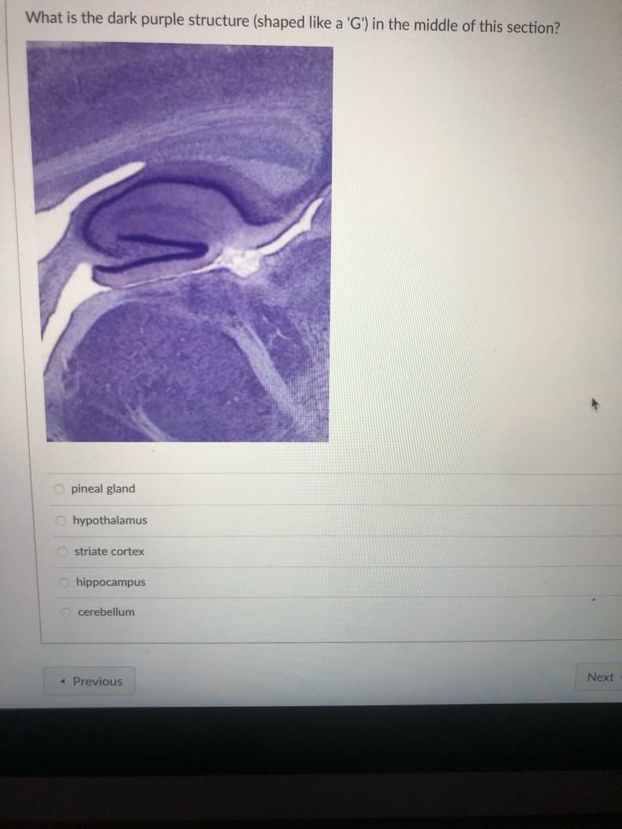 What is the dark purple structure (shaped like a 'G') in the middle of this section?
0000
pineal gland
Ohypothalamus
Ostriate cortex
Ohippocampus
Ocerebellum
< Previous
Next