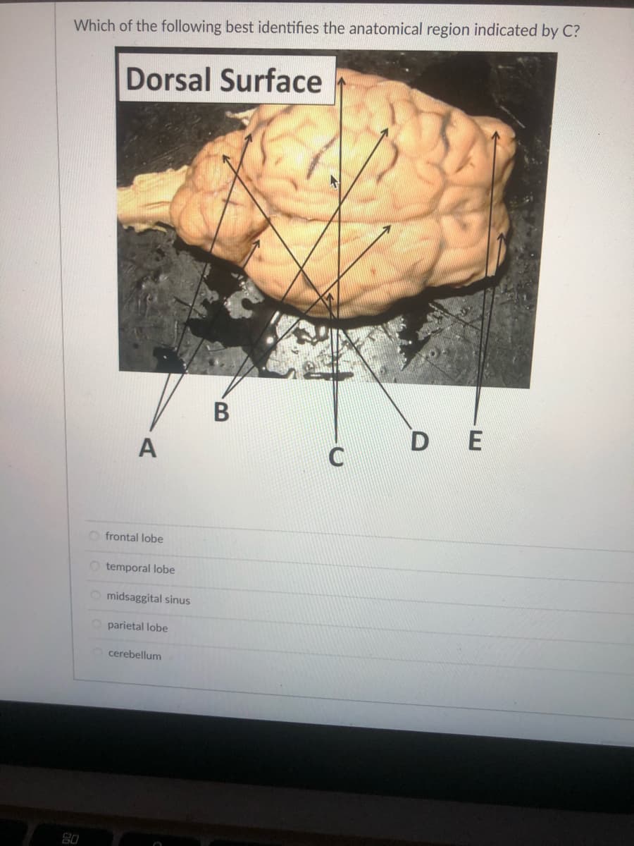 Which of the following best identifies the anatomical region indicated by C?
20
Dorsal Surface
A
Ofrontal lobe
O temporal lobe
Omidsaggital sinus
parietal lobe
Ocerebellum
B
C
DE