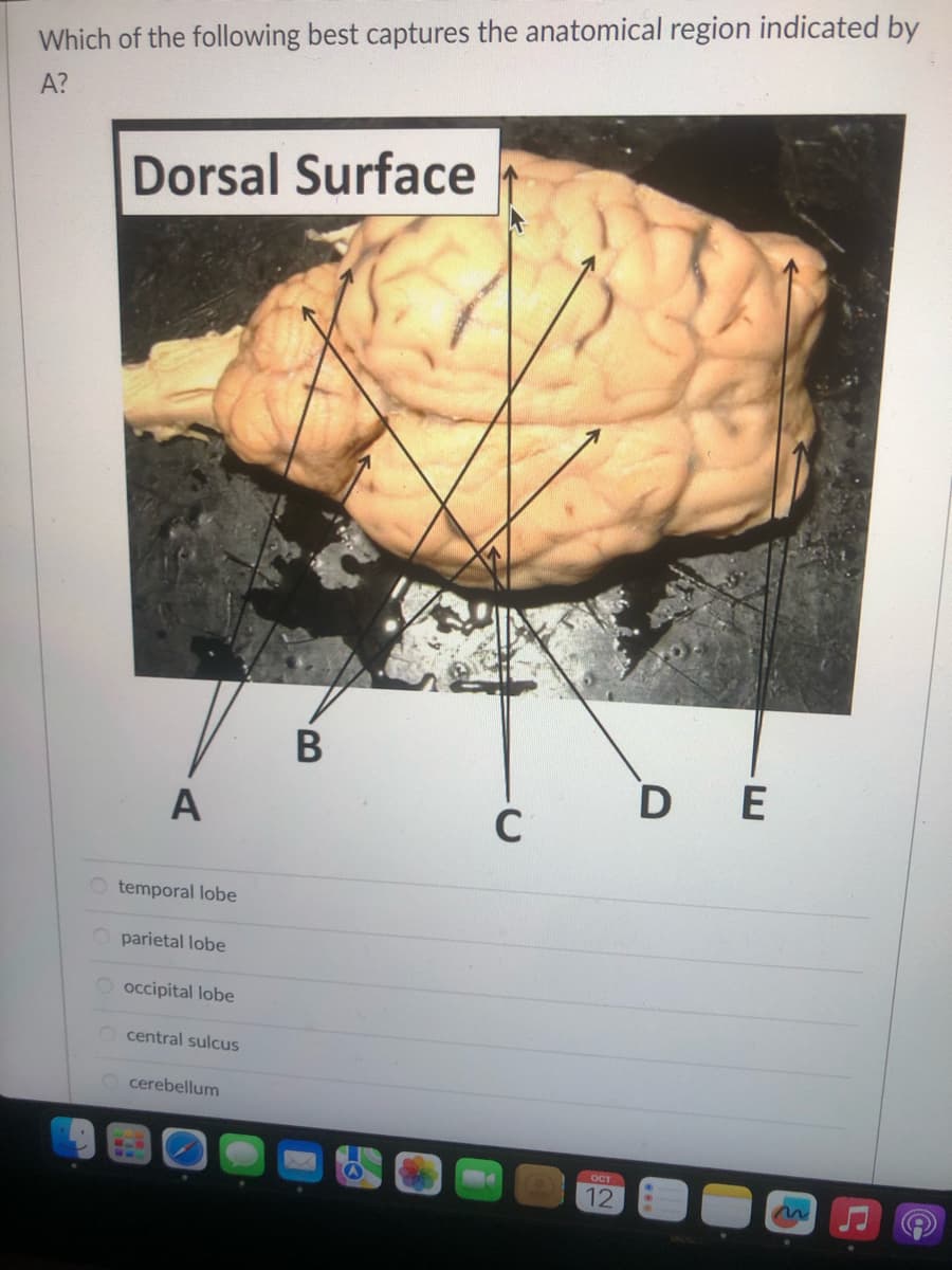 Which of the following best captures the anatomical region indicated by
A?
Dorsal Surface
A
O temporal lobe
parietal lobe
O occipital lobe
central sulcus
cerebellum
B
C
ост
12
DE
m
e