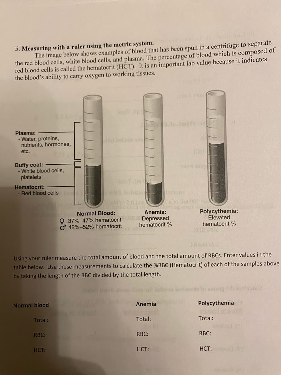 5. Measuring with a ruler using the metric system. scopun enolichi
The image below shows examples of blood that has been spun in a centrifuge to separate
the red blood cells, white blood cells, and plasma. The percentage of blood which is composed of
red blood cells is called the hematocrit (HCT). It is an important lab value because it indicates
the blood's ability to carry oxygen to working tissues.
Plasma:
- Water, proteins,
nutrients, hormones,
etc.
Buffy coat:
- White blood cells,
platelets
Hematocrit:
- Red blood cells (c
Normal blood
Total:
RBC:
HCT:
In) boboon om
Normal Blood:
37% -47% hematocrit
O 42%-52% hematocrit
100, 10 m01:00
with utiolations.
woled bassil
Anemia:
Depressed
hematocrit %
HOMM
Using your ruler measure the total amount of blood and the total amount of RBCs. Enter values in the
table below. Use these measurements to calculate the %RBC (Hematocrit) of each of the samples above
by taking the length of the RBC divided by the total length.
TolBW Joy
sech of a 30 Jm 007
lowing
Anemia
Total:
RBC:
DER
190EW inay
HCT:
Polycythemia:
Elevated
hematocrit %
202 202
Polycythemia
Total:
RBC:
HCT: