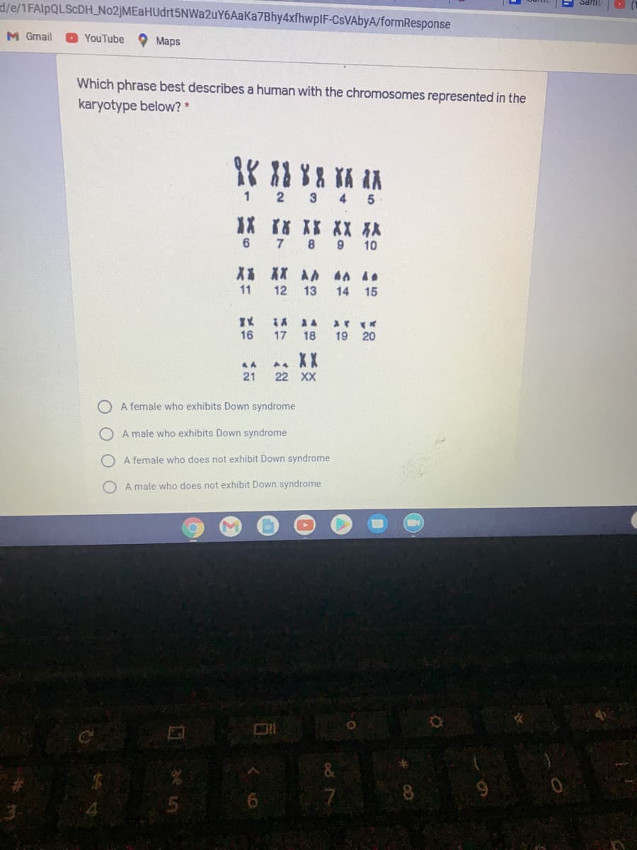 d/e/1FAIPQLSCDH_No2]MEaHUdrt5NWa2uY6AaKa7Bhy4xfhwplF-CsVAbyA/formResponse
M Gmail
YouTube
O Maps
Which phrase best describes a human with the chromosomes represented in the
karyotype below? *
1
3
4 5
X r8 K* XX从
6.
8
9.
10
X* ** **
11
12 13
14
15
16
17
18
19 20
XX
44
21
22 XX
O A female who exhibits Down syndrome
A male who exhibits Down syndrome
O A female who does not exhibit Down syndrome
O A male who does not exhibit Down syndrome
8.
