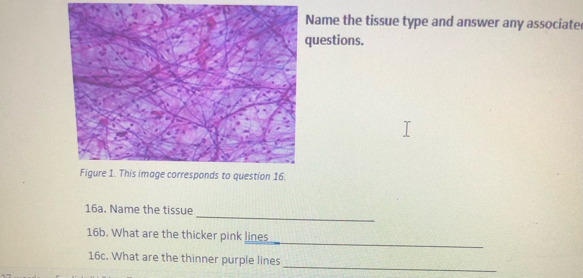 Name the tissue type and answer any associatec
questions.
Figure 1. This image corresponds to question 16.
16a. Name the tissue
16b. What are the thicker pink lines
16c. What are the thinner purple lines
