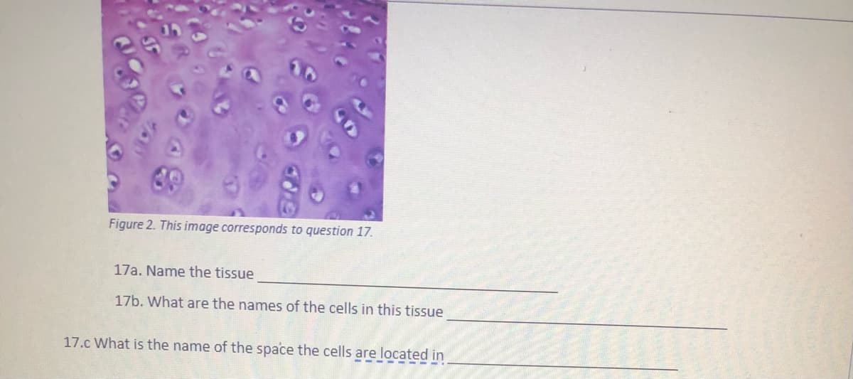 Figure 2. This image corresponds to question 17.
17a. Name the tissue
17b. What are the names of the cells in this tissue
17.c What is the name of the space the cells are located in
