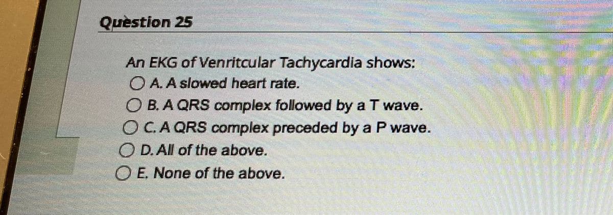 Question 25
An EKG of Venritcular Tachycardia shows:
A. A slowed heart rate.
O B. A QRS complex followed by a T wave.
OC. A QRS complex preceded by a P wave.
D. All of the above.
OE. None of the above.