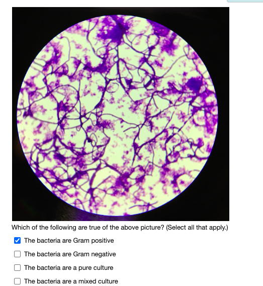Which of the following are true of the above picture? (Select all that apply.)
V The bacteria are Gram positive
The bacteria are Gram negative
The bacteria are a pure culture
The bacteria are a mixed culture
