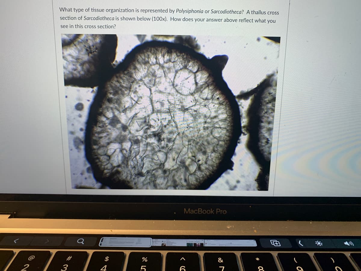 What type of tissue organization is represented by Polysiphonia or Sarcodiotheca? A thallus cross
section of Sarcodiotheca is shown below (100x). How does your answer above reflect what you
see in this cross section?
MacBook Pro
@
23
$
%
&
2
3
4
5
6.
8

