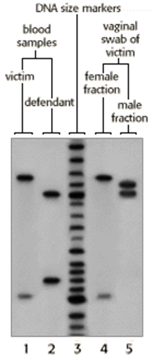 DNA size markers
blood
samples
victim
defendant
vaginal
swab of
victim
female
fraction
male
fraction
1
1 2 3 4 5