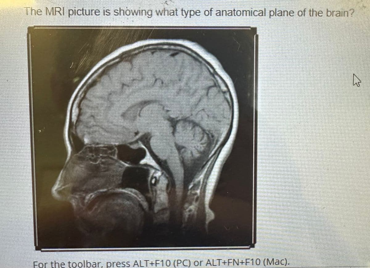 The MRI picture is showing what type of anatomical plane of the brain?
For the toolbar, press ALT+F10 (PC) or ALT+FN+F10 (Mac).