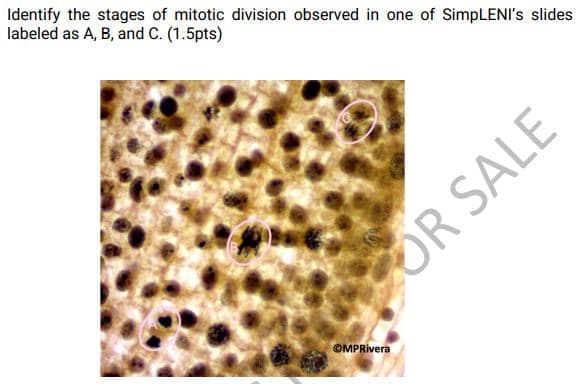 Identify the stages of mitotic division observed in one of SimpLENI's slides
labeled as A, B, and C. (1.5pts)
OR SALE
OMPRivera
