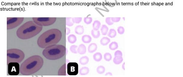Compare the cells in the two photomicrographs below in terms of their shape and
structure(s).
А
B
