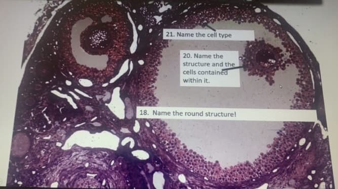 21. Name the cell type
20. Name the
structure and the
cells contained
within it.
18. Name the round structure!
