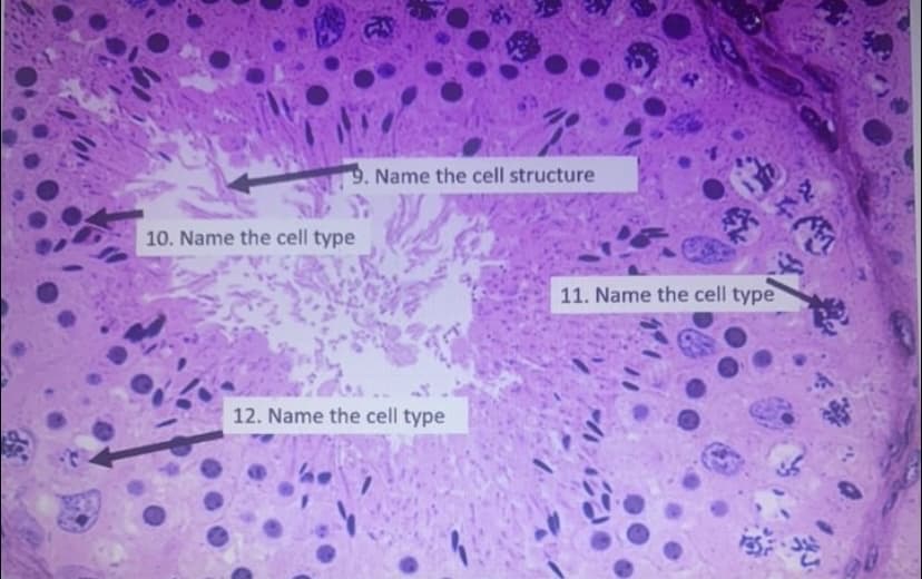 9. Name the cell structure
10. Name the cell type
11. Name the cell type
12. Name the cell type
