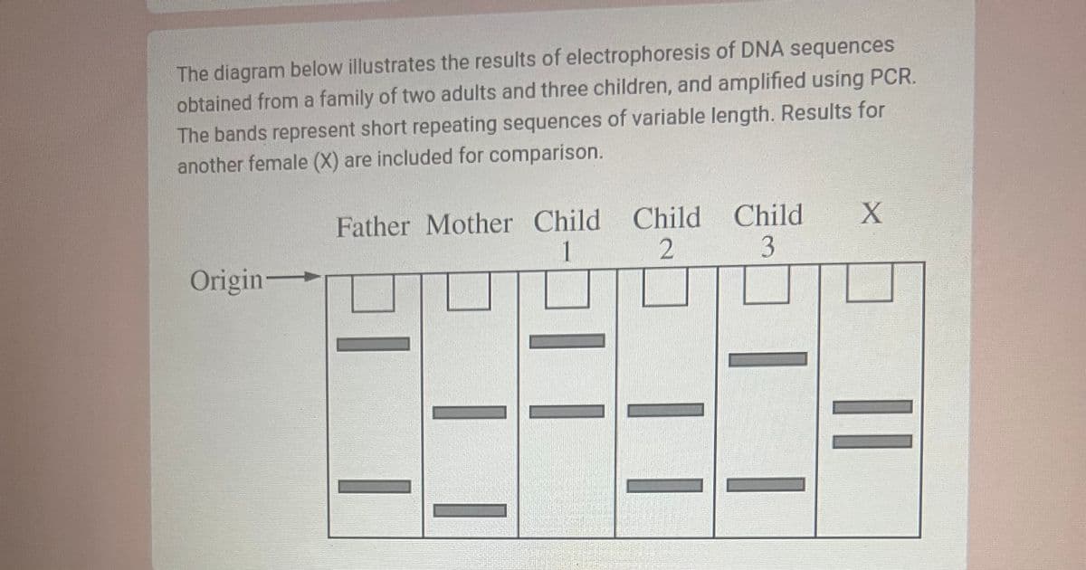 The diagram below illustrates the results of electrophoresis of DNA sequences
obtained from a family of two adults and three children, and amplified using PCR.
The bands represent short repeating sequences of variable length. Results for
another female (X) are included for comparison.
Father Mother Child Child
Child
X
1
2
3
Origin―