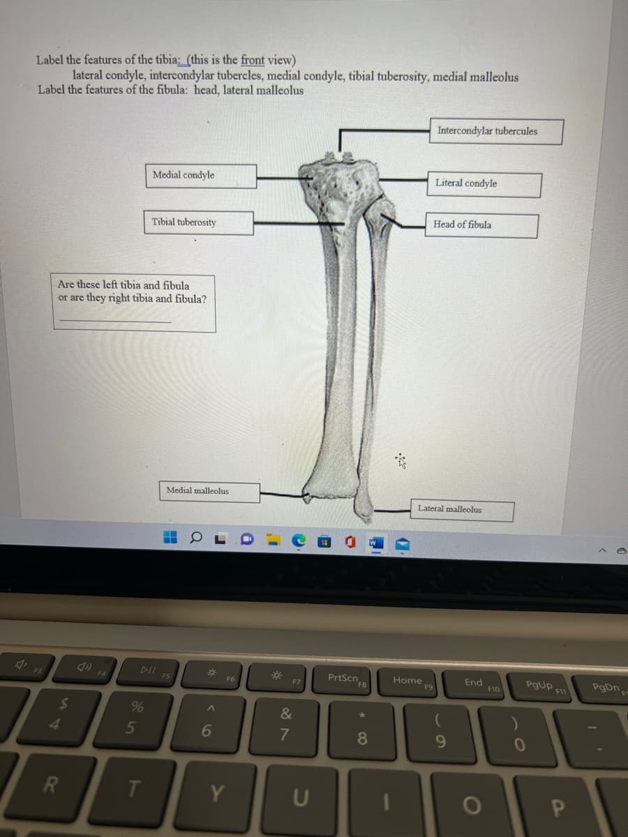 Label the features of the tibia:_ (this is the front view)
lateral condyle, intercondylar tubercles, medial condyle, tibial tuberosity, medial malleolus
Label the features of the fibula: head, lateral malleolus
F3
$
Are these left tibia and fibula
or are they right tibia and fibula?
4
R
%
5
Medial condyle
Tibial tuberosity
T
Medial malleolus
DII FS
H
*
^
6
F6
Y
*
F7
&
7
PrtScn F8
*80
11
1
Intercondylar tubercules
Home
Literal condyle
Head of fibula
Lateral malleolus
9
End
O
F10
PgUp F11
0
P
PgDn