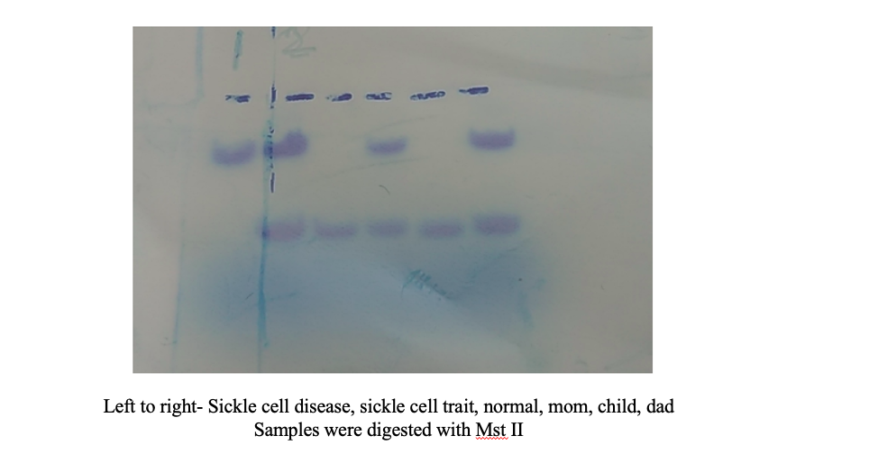 Left to right- Sickle cell disease, sickle cell trait, normal, mom, child, dad
Samples were digested with Mst II
