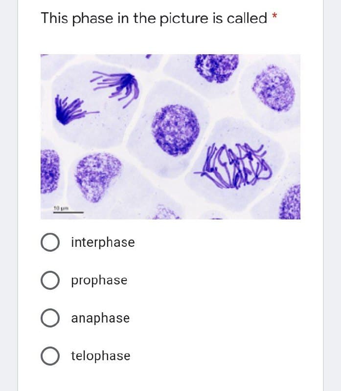 *
This phase in the picture is called
O interphase
O prophase
O anaphase
O telophase