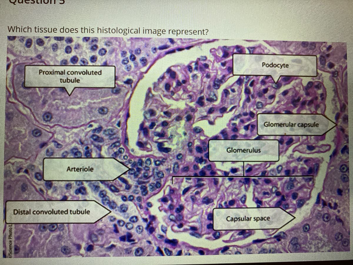 Which tissue does this histological image represent?
Podocyte
Proximal convoluted
tubule
Glomerular capsule
Glomerulus
Arteriole
Distal convoluted tubule
Capsular space
Sdience Photo L
