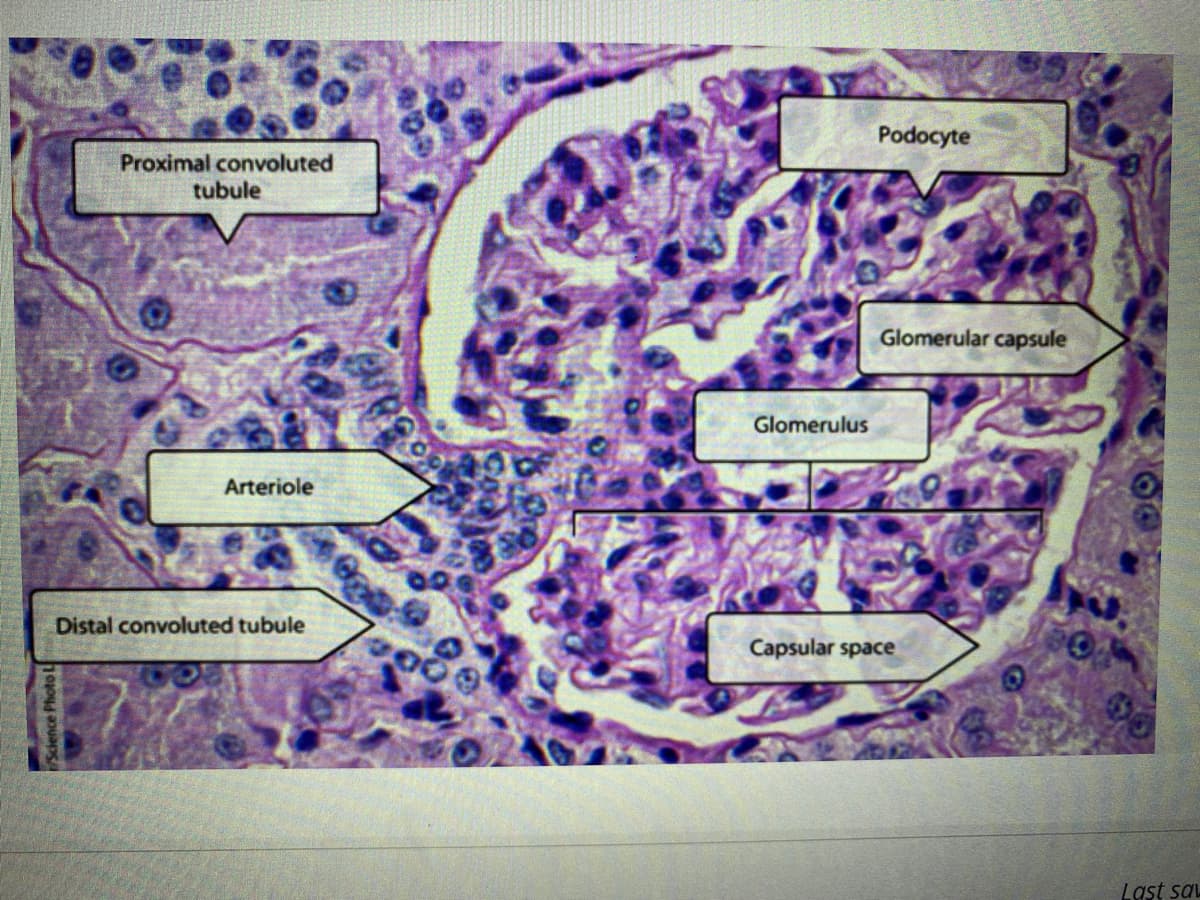 Podocyte
Proximal convoluted
tubule
Glomerular capsule
Glomerulus
Arteriole
Distal convoluted tubule
Capsular space
Last sa
iScience Photo L
