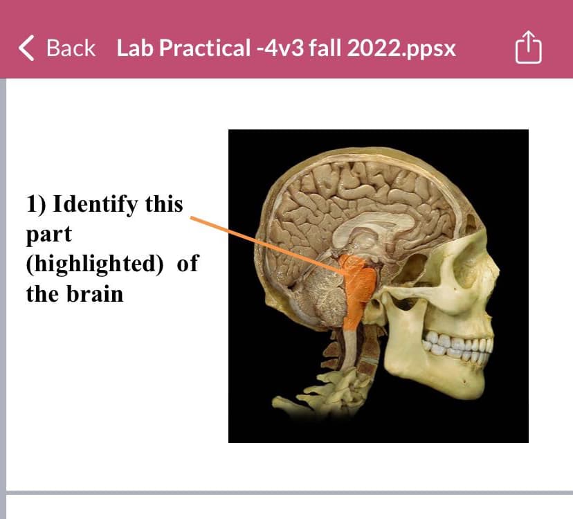 Back Lab Practical -4v3 fall 2022.ppsx
1) Identify this
part
(highlighted) of
the brain
13