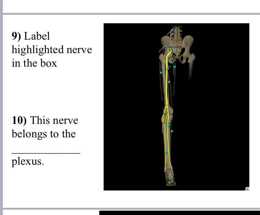 9) Label
highlighted nerve
in the box
10) This nerve
belongs to the
plexus.