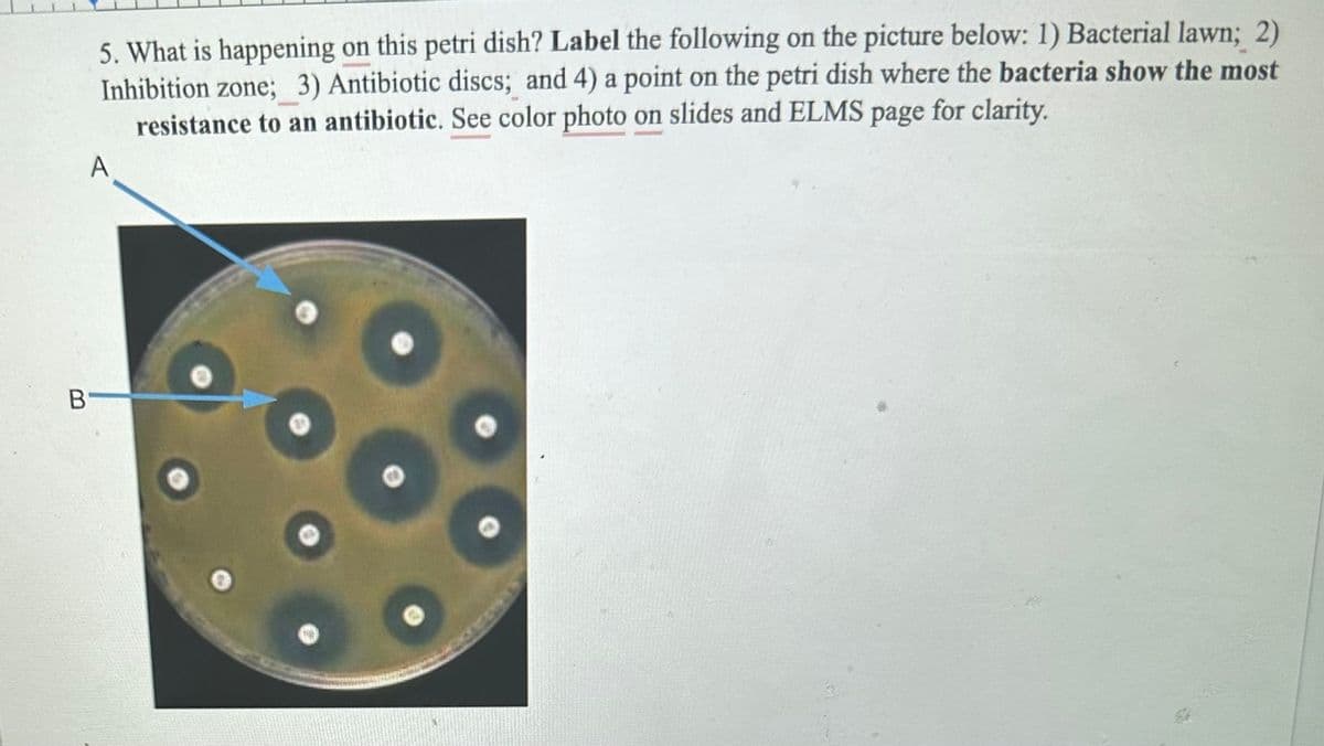 5. What is happening on this petri dish? Label the following on the picture below: 1) Bacterial lawn; 2)
Inhibition zone; 3) Antibiotic discs; and 4) a point on the petri dish where the bacteria show the most
page for clarity.
resistance to an antibiotic. See color photo on slides and ELMS
A
В'
500