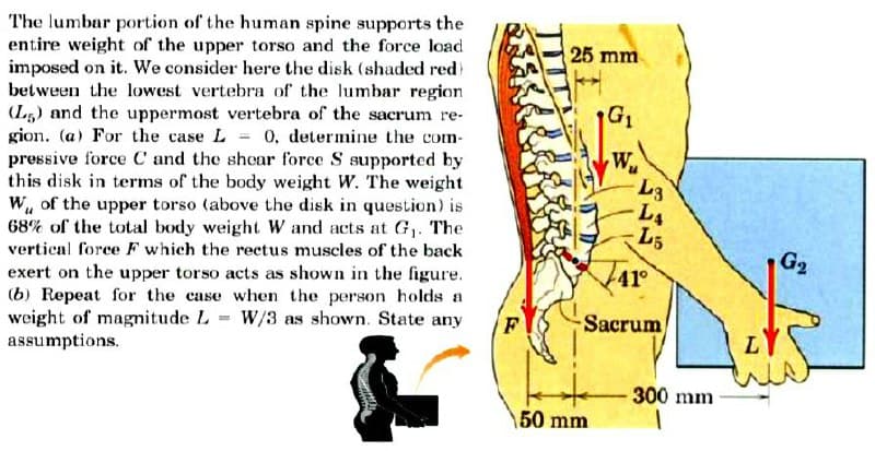 The lumbar portion of the human spine supports the
entire weight of the upper torso and the force load
imposed on it. We consider here the disk (shaded red)
between the lowest vertebra of the lumbar region
(L5) and the uppermost vertebra of the sacrum re-
gion. (a) For the case L 0, determine the com-
pressive force C and the shear force S supported by
this disk in terms of the body weight W. The weight
W, of the upper torso (above the disk in question) is
68% of the total body weight W and acts at G,. The
vertical force F which the rectus muscles of the back
25 mm
G1
W
L3
L4
L5
G2
4r
exert on the upper torso acts as shown in the figure.
(b) Repeat for the case when the person holds a
weight of magnitude L W/3 as shown. State any
assumptions.
F
Sacrum
300 mm
\50 mm
