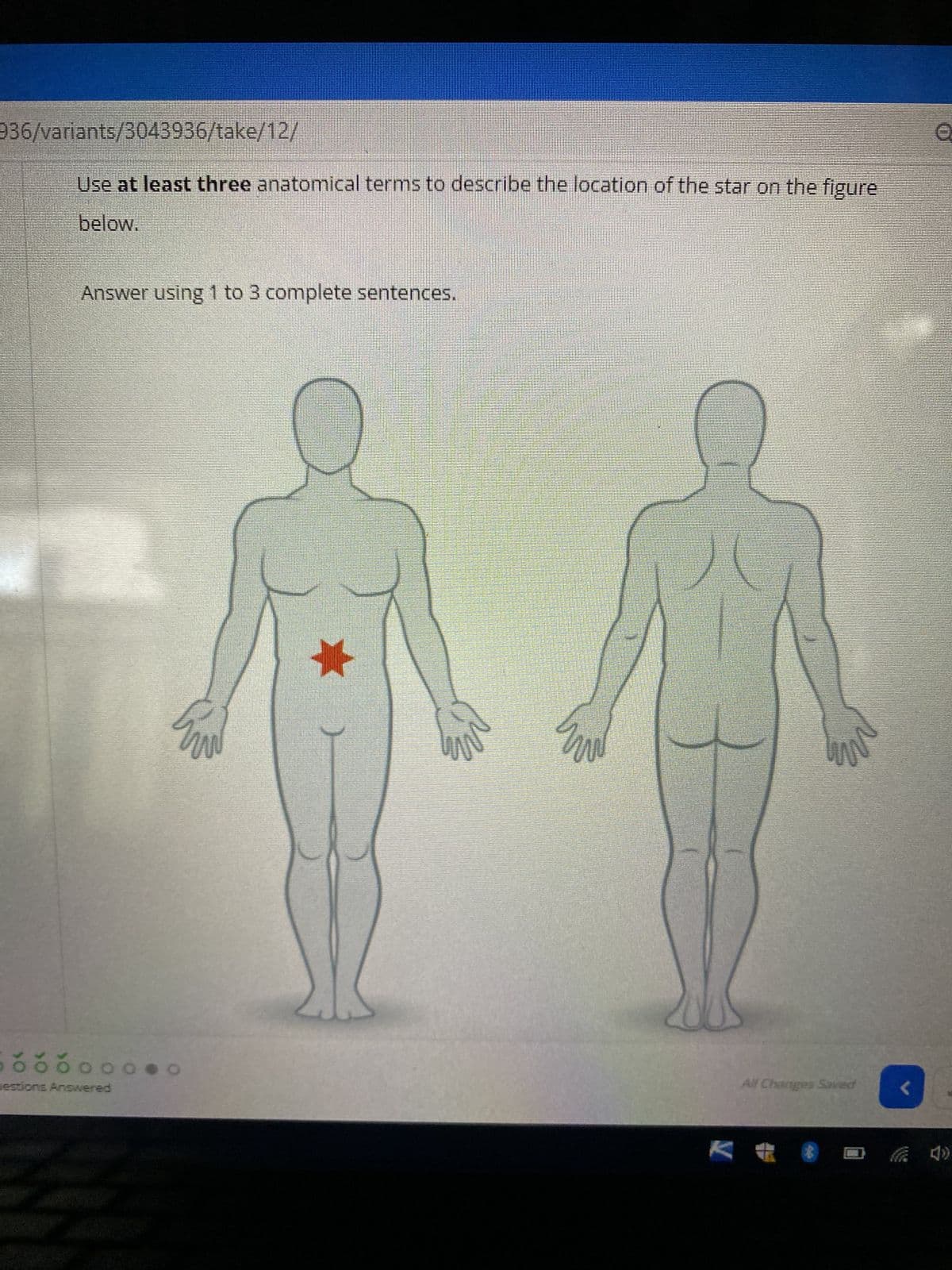 936/variants/3043936/take/12/
Use at least three anatomical terms to describe the location of the star on the figure
below.
Answer using 1 to 3 complete sentences.
ooooo
estions Answered
O
t
UN
All Changes Saved
<
Q