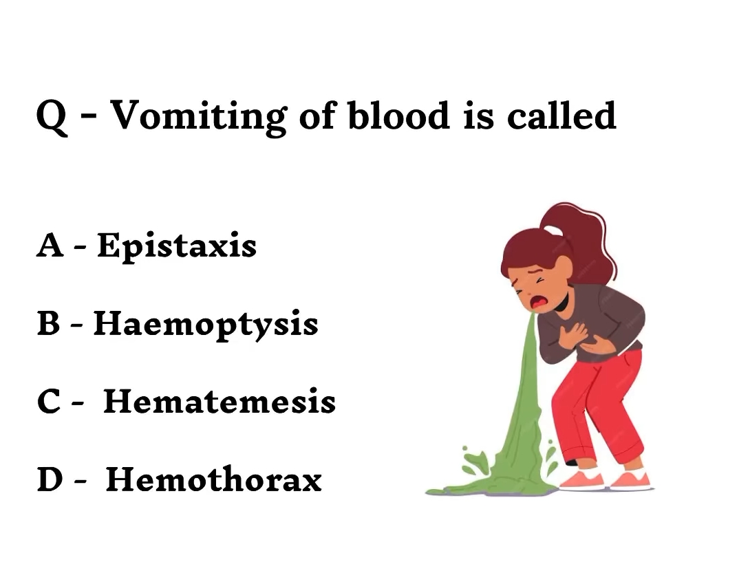 Q - Vomiting of blood is called
A - Epistaxis
B - Haemoptysis
C - Hematemesis
D Hemothorax