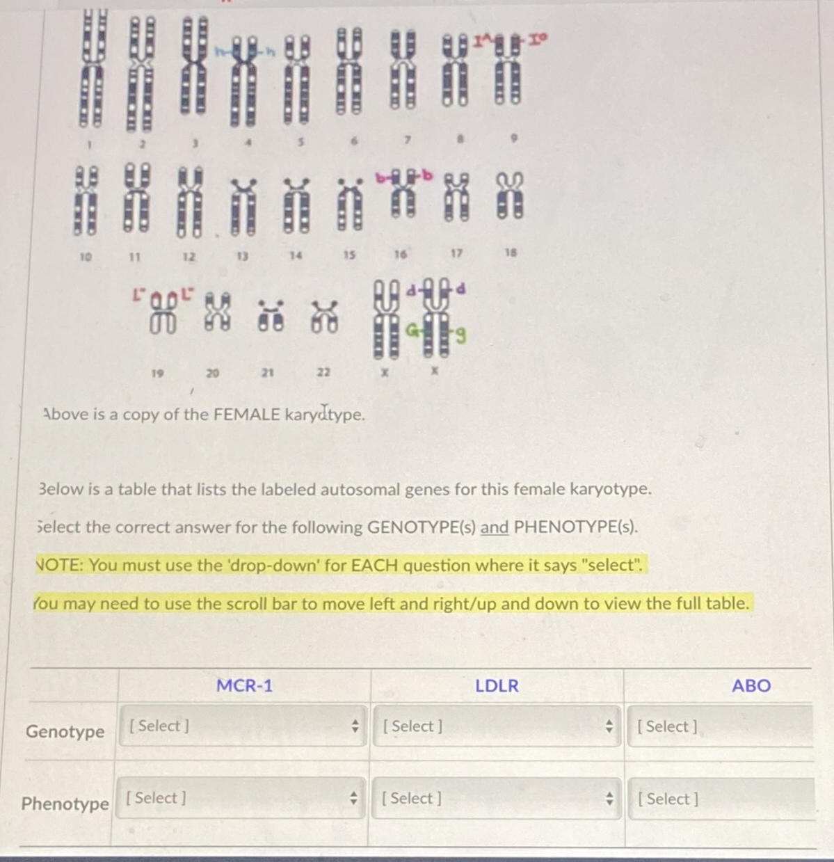 BED
90
10
AMITAD
Genotype
HEAD
Phenotype
FODE
"H
20
[Select]
Above is a copy of the FEMALE karydtype.
[Select]
14
D
******
22
MCR-1
A
6
FDE
Below is a table that lists the labeled autosomal genes for this female karyotype.
Select the correct answer for the following GENOTYPE(s) and PHENOTYPE(s).
NOTE: You must use the 'drop-down' for EACH question where it says "select".
You may need to use the scroll bar to move left and right/up and down to view the full table.
AND
Add
+ [Select]
7
[Select]
LDLR
[Select]
[Select]
ABO