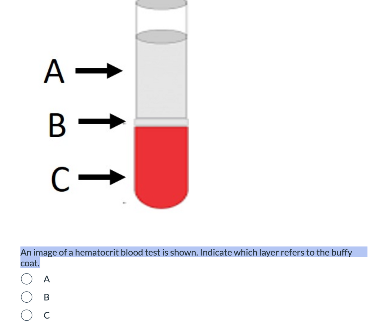 A-
B
↑ ↑
C-
An image of a hematocrit blood test is shown. Indicate which layer refers to the buffy
coat.
A
B
Ос