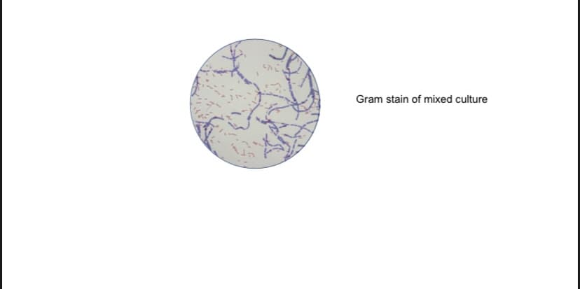 Gram stain of mixed culture