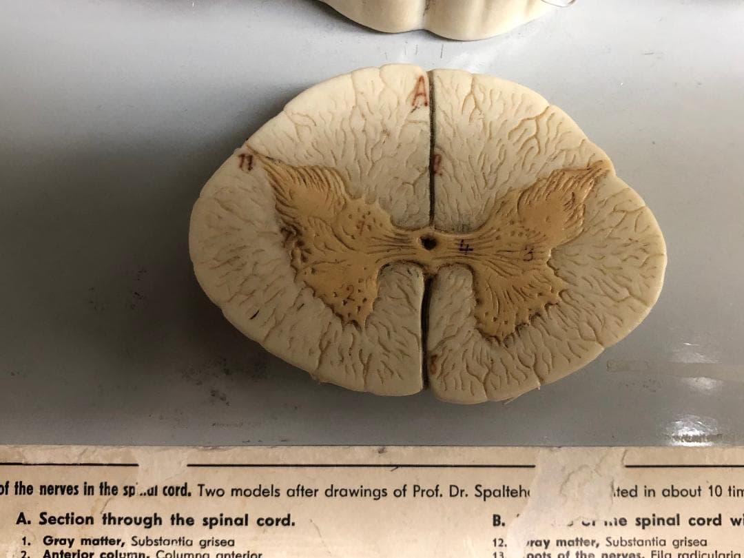 of the nerves in the sp.al cord. Two models after drawings of Prof. Dr. Spaltehe
ted in about 10 tim
A. Section through the spinal cord.
В.
r nie spinal cord wi
1. Gray matter, Substantia grisea
Anterior column, Columng anterior
ray matter, Substantia grisea
oots of the nerves, Fila radicularia
12.
2.
13
