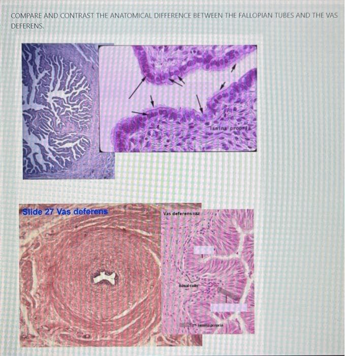 COMPARE AND CONTRAST THE ANATOMICAL DIFFERENCE BETWEEN THE FALLOPIAN TUBES AND THE VAS
DEFERENS.
Tamina propr
Slide 27 Vas deferens
Vas deferens E
lanina propri
