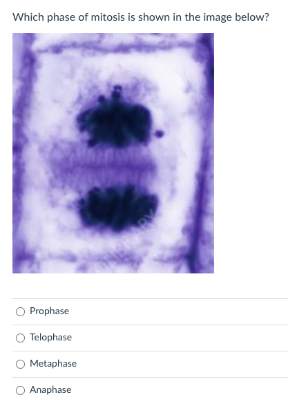 Which phase of mitosis is shown in the image below?
Prophase
Telophase
O Metaphase
O Anaphase
ARY
