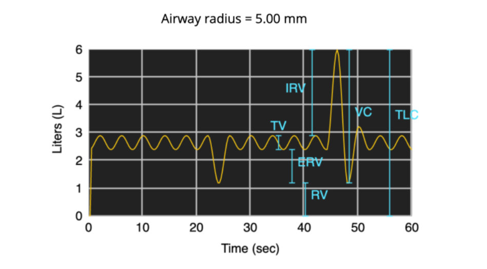 Airway radius = 5.00 mm
5
IRV
4
TLC
TV
3
2
ERV
1
RV
10
20
30
40
50 60
Time (sec)
Liters (L)
